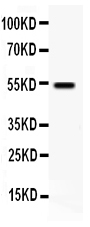 1 - Anti-VIP Receptor 1 Antibody ABO11066