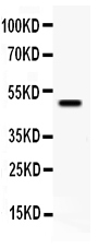 1 - Anti-YB1 Antibody ABO11067