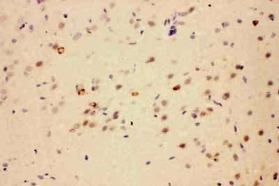 2 - Anti-CACYBP Antibody ABO11068