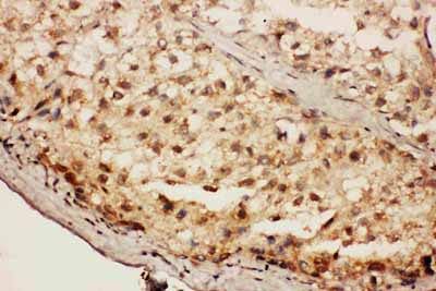 2 - Anti-CACYBP Antibody ABO11068