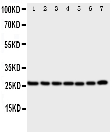 1 - Anti-CACYBP Antibody ABO11068
