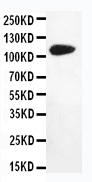 1 - Anti-DPYD Antibody ABO11070