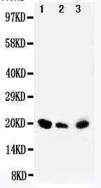 1 - Anti-DUSP3 Antibody ABO11071