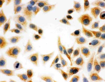 8 - Anti-DCI Antibody ABO11072