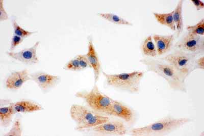 8 - Anti-DCI Antibody ABO11072