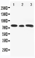 1 - Anti-Gli3 Antibody ABO11075