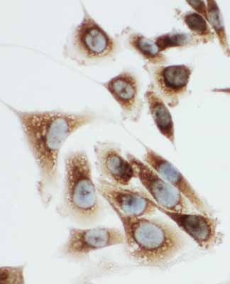 8 - Anti-Kallikrein-6 Antibody ABO11076