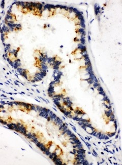 2 - Anti-Kallikrein-6 Antibody ABO11076