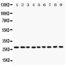 1 - Anti-Kallikrein-6 Antibody ABO11076