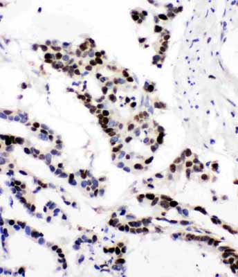 2 - Anti-MCM6 Antibody ABO11077