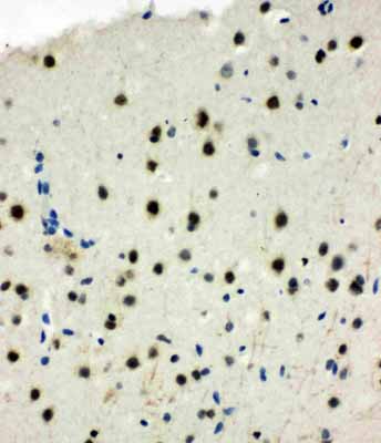 2 - Anti-MCM6 Antibody ABO11077