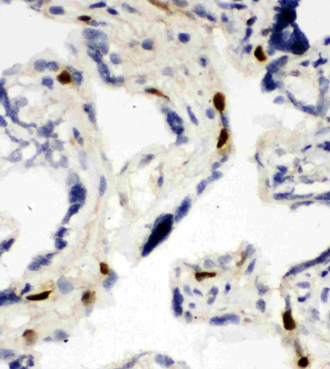 2 - Anti-MCM6 Antibody ABO11077