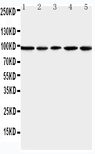 1 - Anti-MCM6 Antibody ABO11077