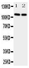 1 - Anti-Neuropilin-2 Antibody ABO11078