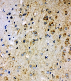 2 - Anti-Rab5 Antibody ABO11080