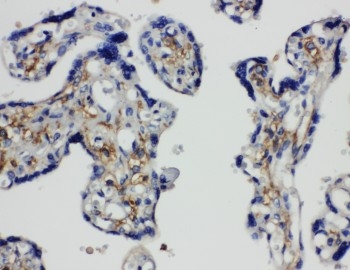 2 - Anti-SNAP23 Antibody ABO11081