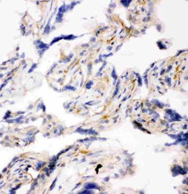 2 - Anti-SNAP23 Antibody ABO11081