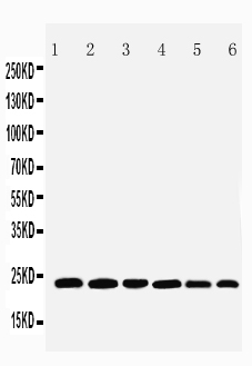 1 - Anti-SNAP23 Antibody ABO11081