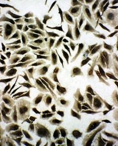 8 - Anti-SNRPN Antibody ABO11082