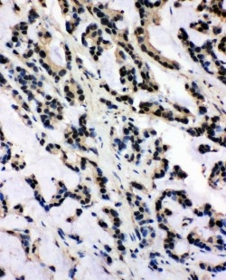 2 - Anti-SNRPN Antibody ABO11082
