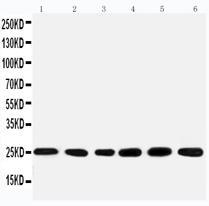 1 - Anti-SNRPN Antibody ABO11082