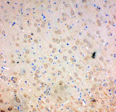 2 - Anti-SOD2 Antibody ABO11083