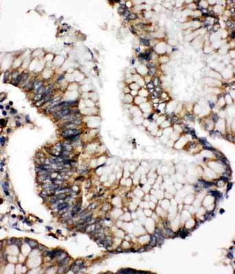 2 - Anti-SOD2 Antibody ABO11083