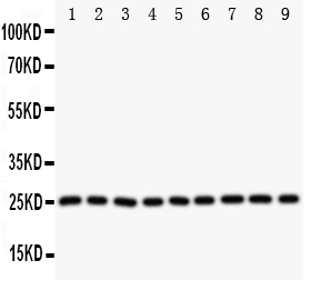 1 - Anti-SOD2 Antibody ABO11083