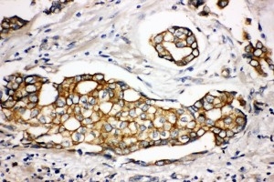 2 - Anti-SPTLC1 Antibody ABO11084
