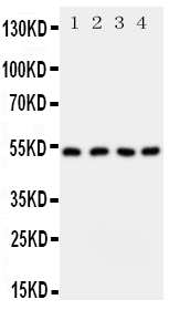 1 - Anti-SPTLC1 Antibody ABO11084