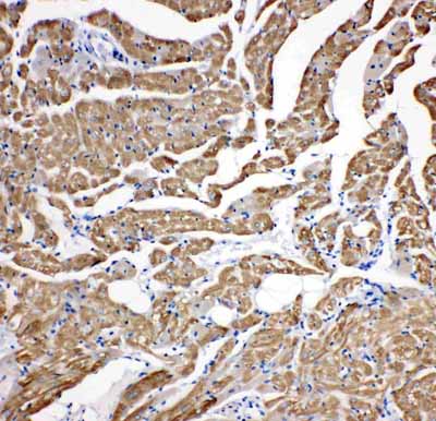 2 - Anti-cardiac Troponin C Antibody ABO11085