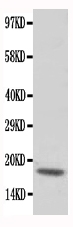 1 - Anti-cardiac Troponin C Antibody ABO11085