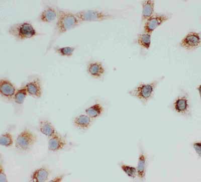 8 - Anti-VDAC/Porin Antibody ABO11086