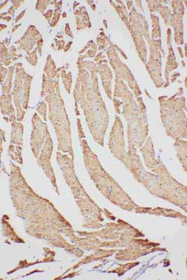2 - Anti-VDAC/Porin Antibody ABO11086