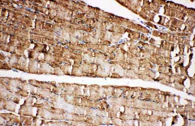 2 - Anti-VDAC/Porin Antibody ABO11086