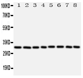 1 - Anti-VDAC/Porin Antibody ABO11086