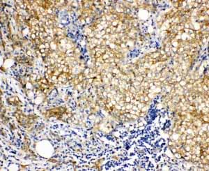 2 - Anti-Vinculin Antibody ABO11087