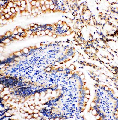 2 - Anti-Vinculin Antibody ABO11087