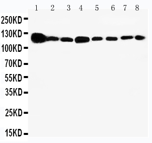 1 - Anti-Vinculin Antibody ABO11087