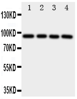 1 - Anti-AHR Antibody ABO11088