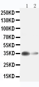 1 - Anti-liver Arginase Antibody ABO11090