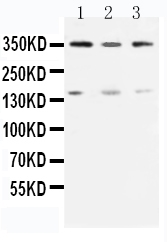 1 - Anti-ATM Antibody ABO11091
