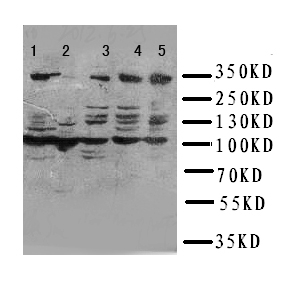 1 - Anti-ATM Antibody ABO11091