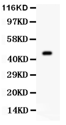 1 - Anti-Aurora A Antibody ABO11092