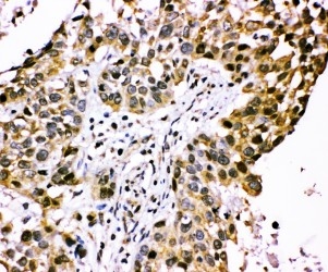 2 - Anti-CISH Antibody ABO11093