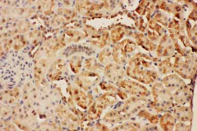 2 - Anti-CISH Antibody ABO11093