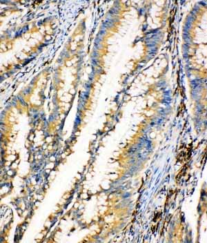 2 - Anti-HEXA Antibody ABO11094