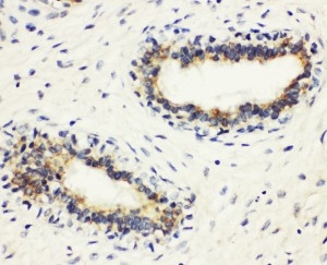 2 - Anti-HLA DMB Antibody ABO11096