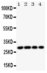 1 - Anti-HLA DMB Antibody ABO11096
