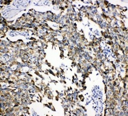 2 - Anti-Grp75 Antibody ABO11097